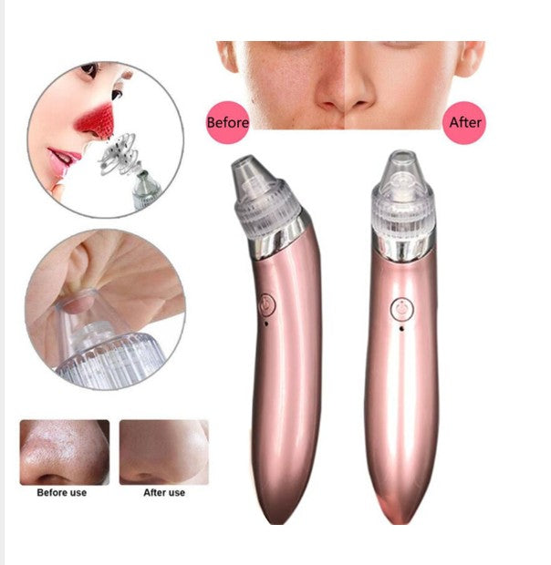 Removedor de Puntos Negros y Limpiador Facial Recargable