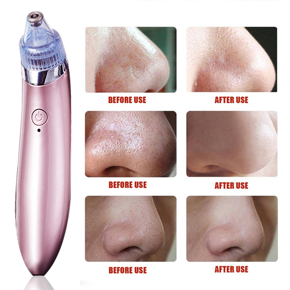 Removedor de Puntos Negros y Limpiador Facial Recargable