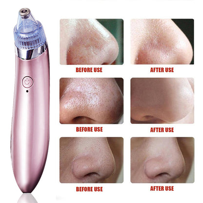 Removedor de Puntos Negros y Limpiador Facial Recargable